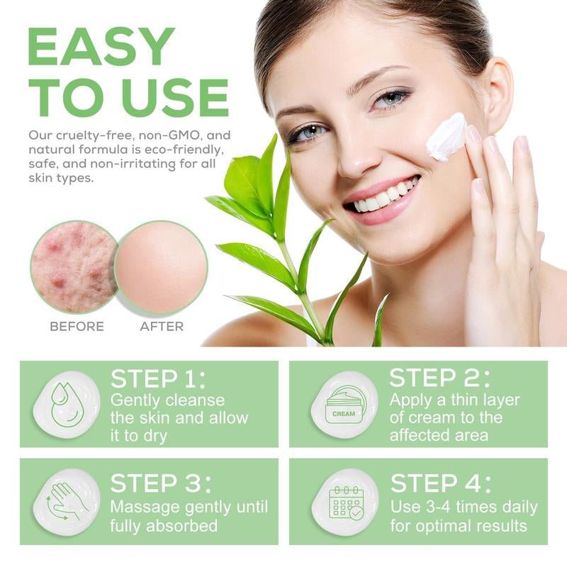 Urea Cream for Dry, Cracked Skin – Moisturizing Foot & Skin Care